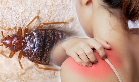 Bedbugs Skin symptoms 1545588