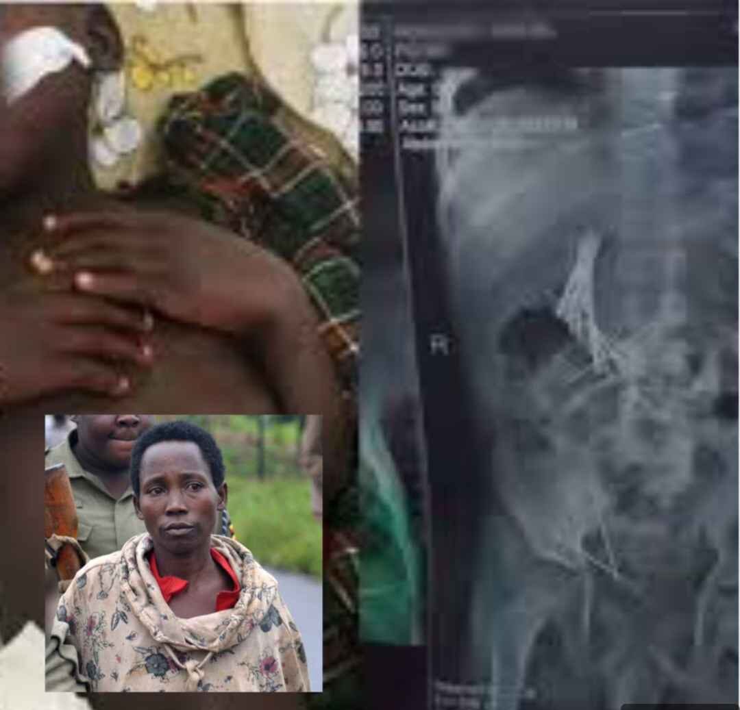 Heartless Creature: Mitooma Woman Arrested For Forcing Stepson To Swallow 46 Needles